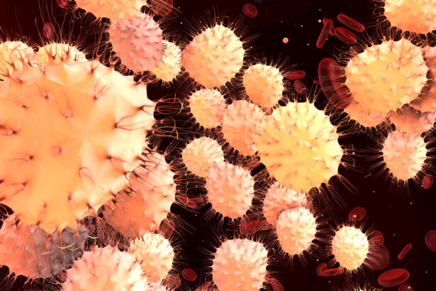 linfoma