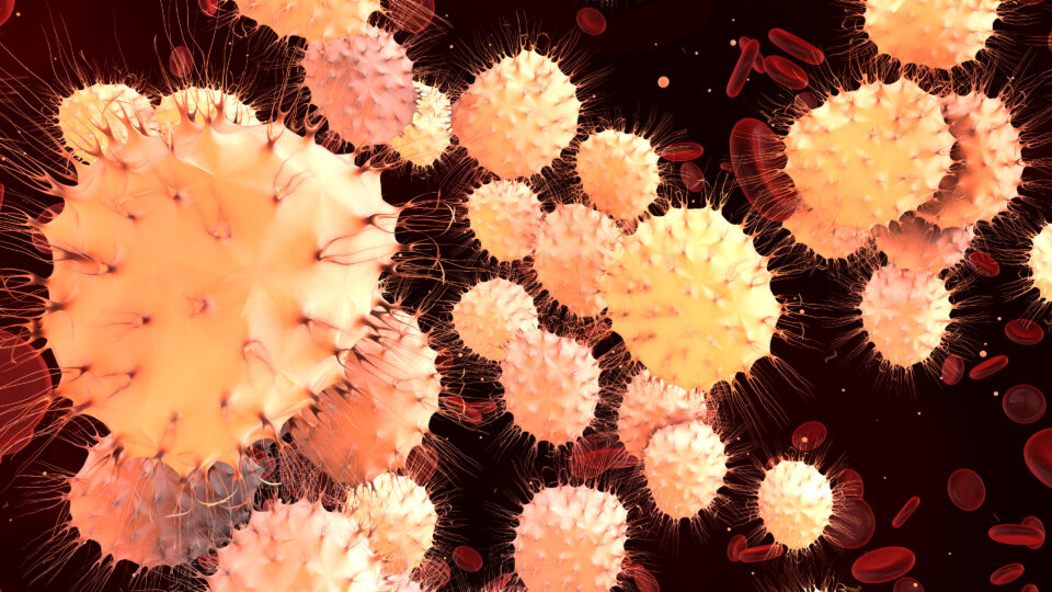 linfoma