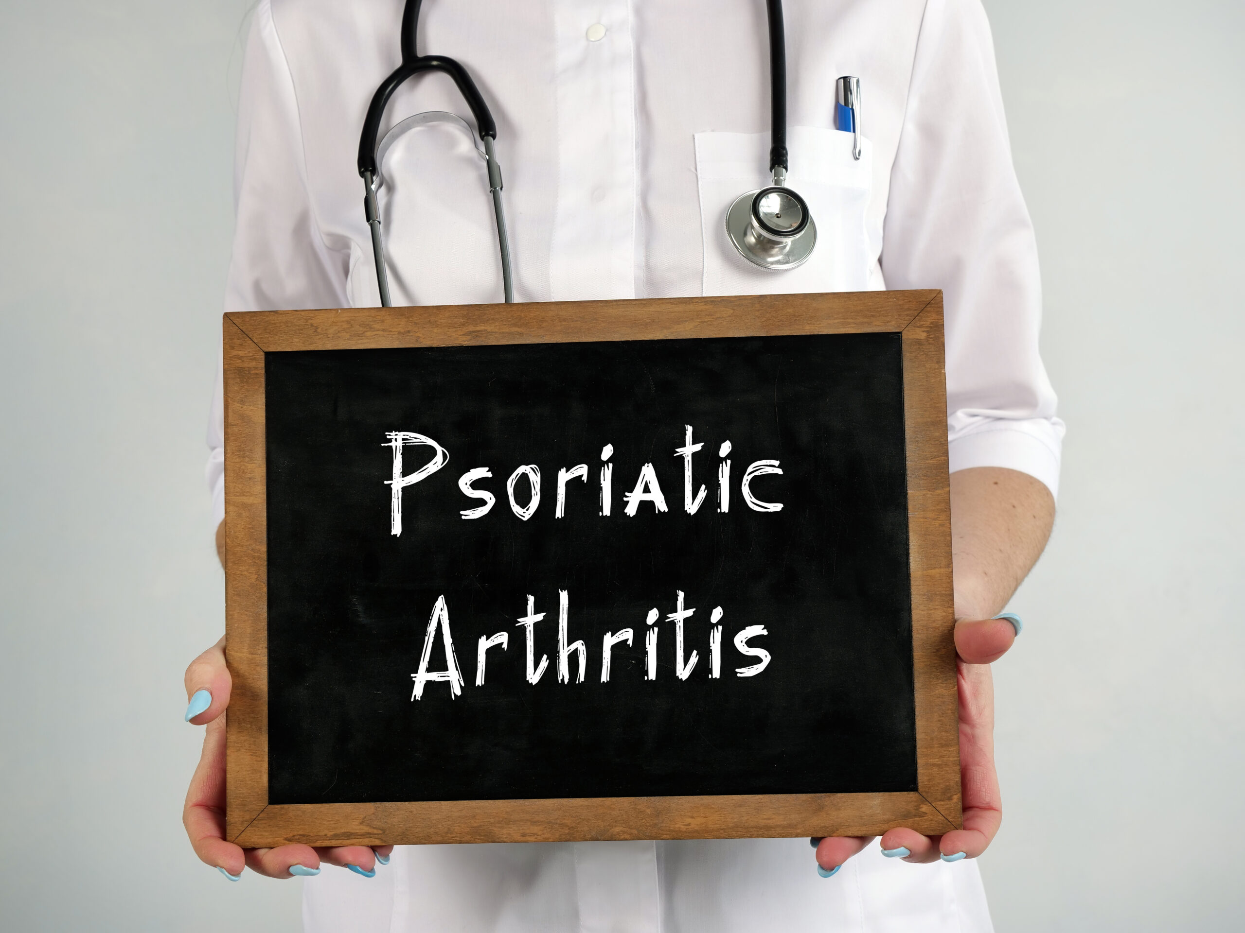 Artrite psoriasica
