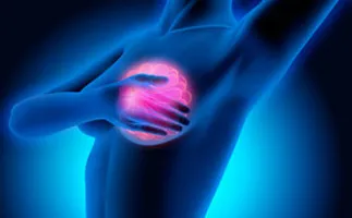 Asco 2024: tumore al seno metastatico, una nuova cura riduce il rischio di morte