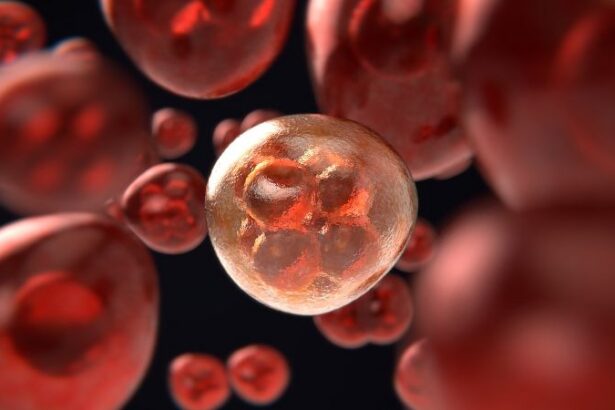 Leucemia linfatica cronica cellule